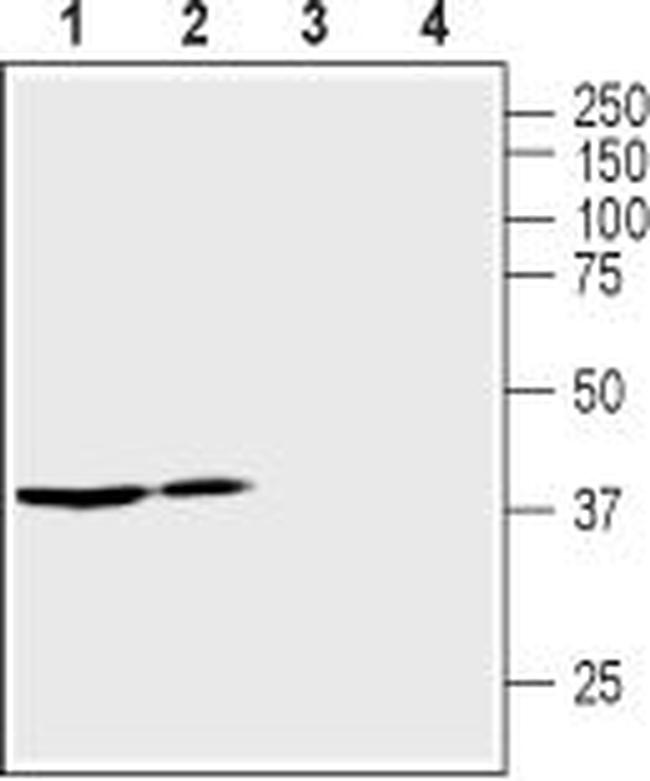 Vasopressin V2 Receptor (AVPR2) Antibody in Western Blot (WB)