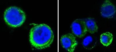 Axl Antibody in Immunocytochemistry (ICC/IF)