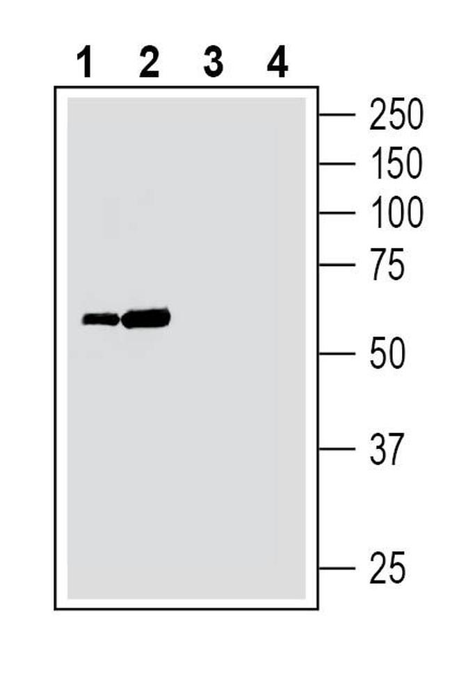 ZIP14 (SLC39A14) Antibody in Western Blot (WB)