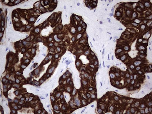 Acidic Cytokeratin Antibody in Immunohistochemistry (Paraffin) (IHC (P))