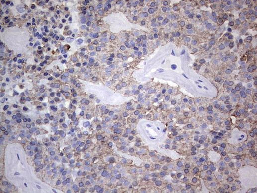 Acidic Cytokeratin Antibody in Immunohistochemistry (Paraffin) (IHC (P))