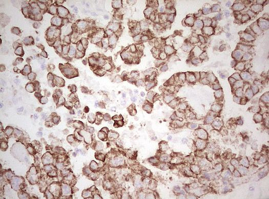 Basic Cytokeratin Antibody in Immunohistochemistry (Paraffin) (IHC (P))