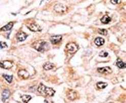 ACVR1 Antibody in Immunohistochemistry (IHC)