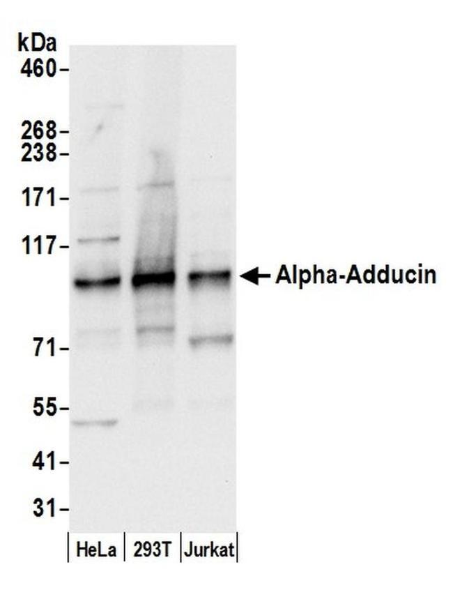 Alpha-Adducin Antibody in Western Blot (WB)