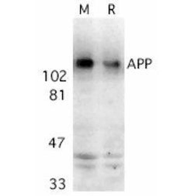 Amyloid Precursor Protein Antibody in Western Blot (WB)