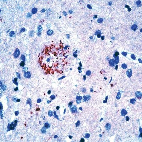 Amyloid Precursor Protein Antibody in Immunohistochemistry (Paraffin) (IHC (P))