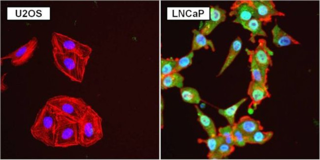 Androgen Receptor Antibody in Immunocytochemistry (ICC/IF)