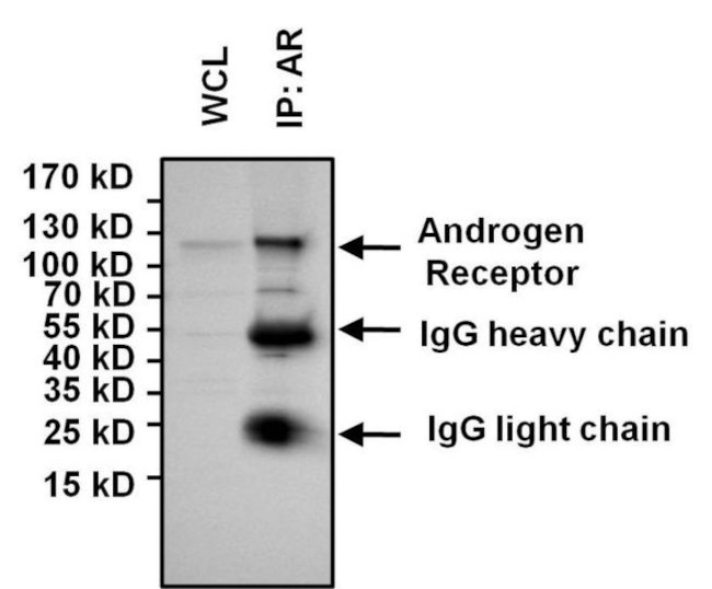 Androgen Receptor Antibody in Immunoprecipitation (IP)