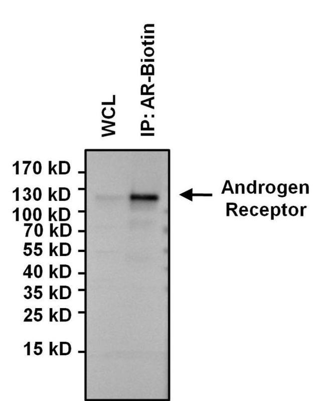 Androgen Receptor Antibody in Western Blot (WB)