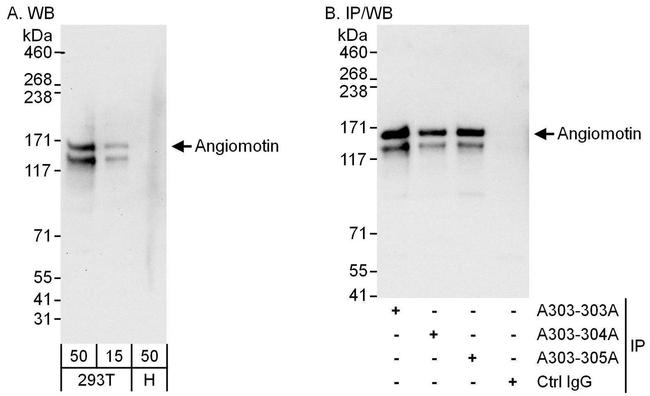 Angiomotin Antibody in Western Blot (WB)