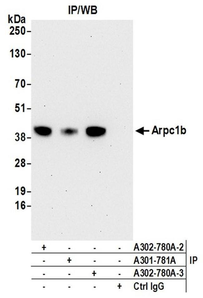Arpc1b Antibody in Western Blot (WB)