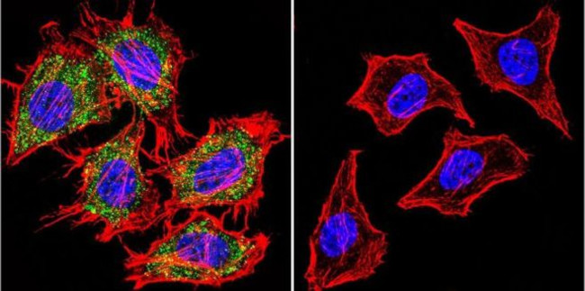 AHR Antibody in Immunocytochemistry (ICC/IF)