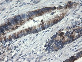 B3GNT2 Antibody in Immunohistochemistry (Paraffin) (IHC (P))