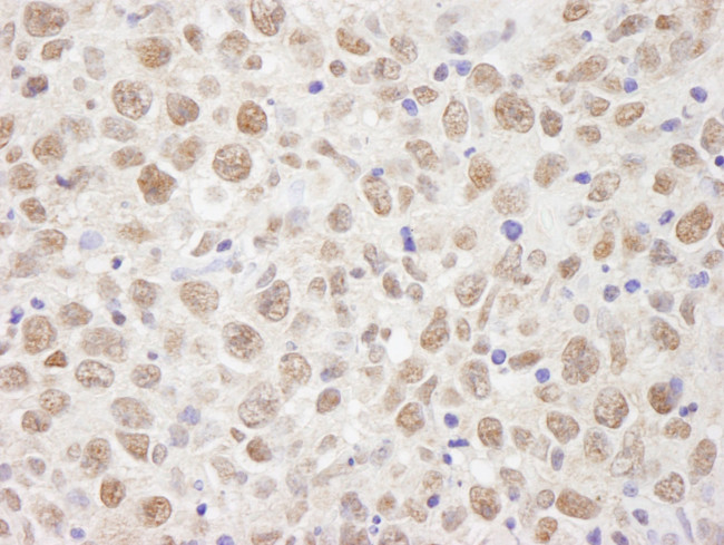 BAAT1 Antibody in Immunohistochemistry (IHC)