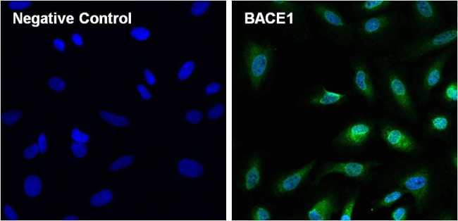 BACE1 Antibody in Immunocytochemistry (ICC/IF)
