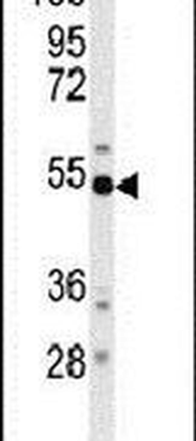 BACE1 Antibody in Western Blot (WB)