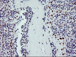 BACH1 Antibody in Immunohistochemistry (Paraffin) (IHC (P))