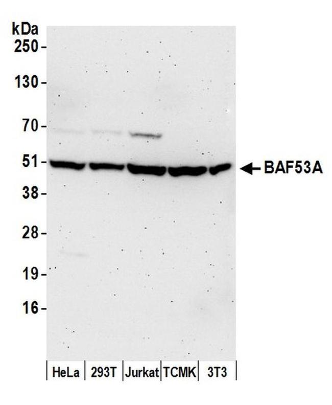 BAF53A Antibody in Western Blot (WB)