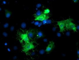 BAIAP2 Antibody in Immunocytochemistry (ICC/IF)