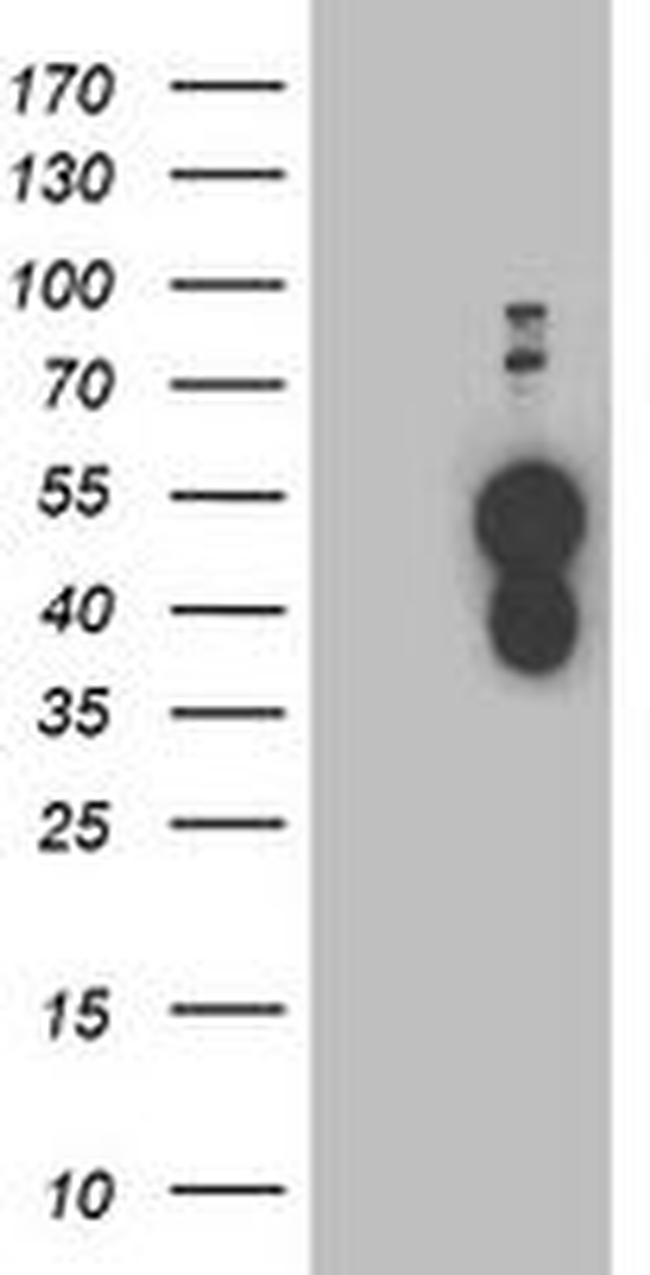 BAIAP2 Antibody in Western Blot (WB)