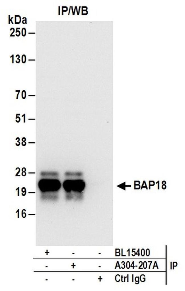 New BAP18 Test Vce