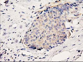 BCAR1 Antibody in Immunohistochemistry (Paraffin) (IHC (P))