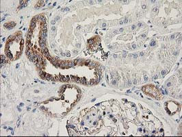 BCAR1 Antibody in Immunohistochemistry (Paraffin) (IHC (P))