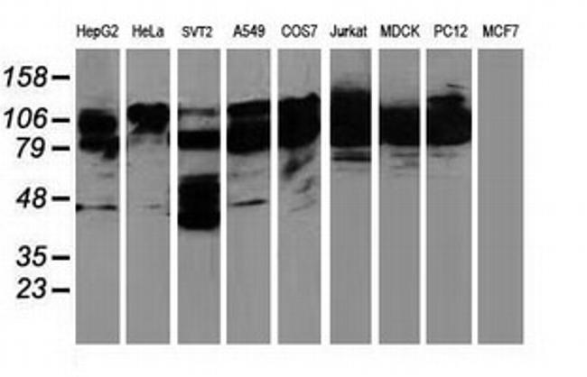 BCAR1 Antibody in Western Blot (WB)