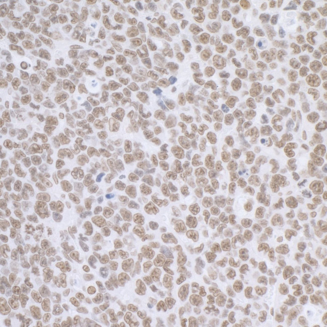 BCAS2 Antibody in Immunohistochemistry (IHC)