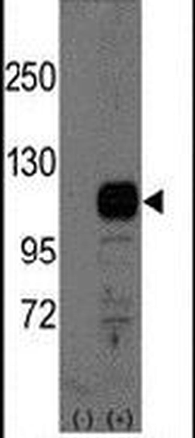 BCAS3 Antibody in Western Blot (WB)