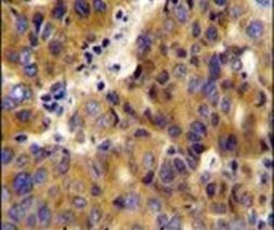 BCKDHB Antibody in Immunohistochemistry (IHC)