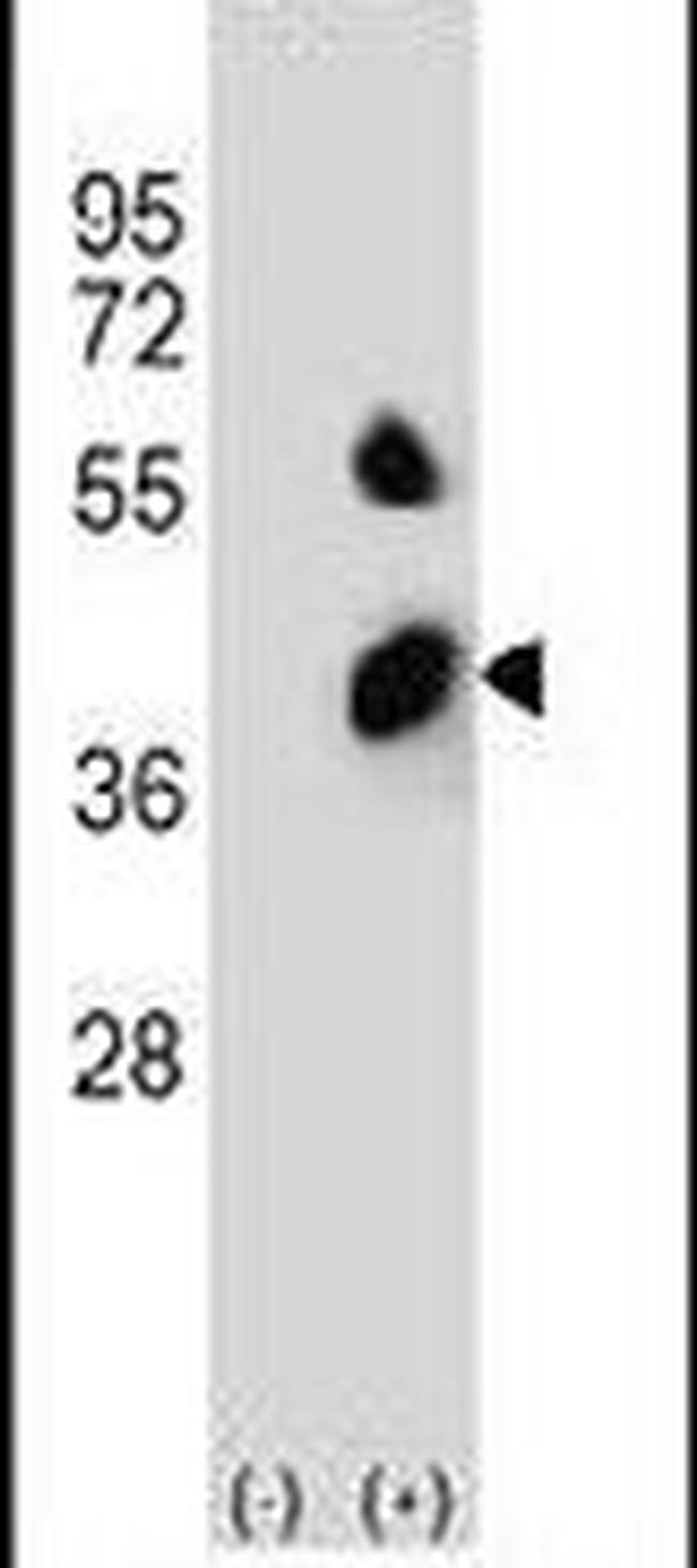 BCKDHB Antibody in Western Blot (WB)