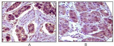 Bcl-10 Antibody in Immunohistochemistry (Paraffin) (IHC (P))