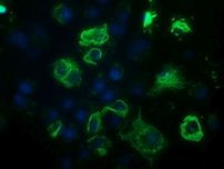 BCL10 Antibody in Immunocytochemistry (ICC/IF)