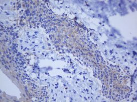 BCL10 Antibody in Immunohistochemistry (Paraffin) (IHC (P))