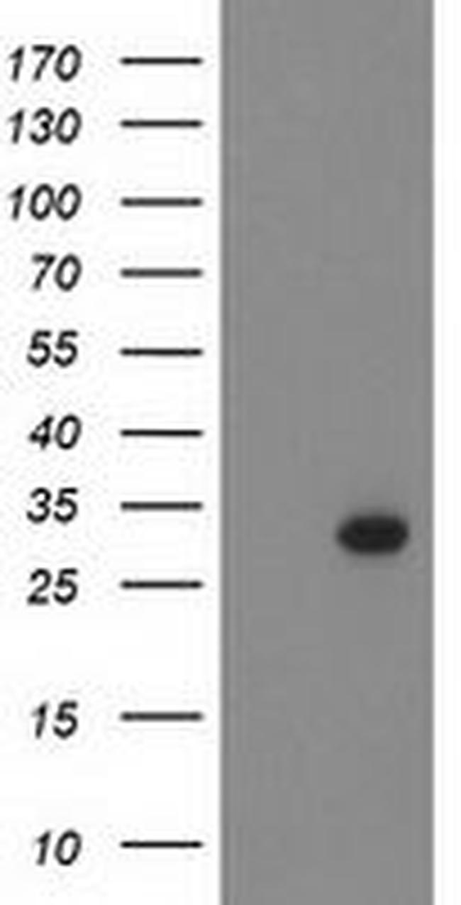 BCL10 Antibody in Western Blot (WB)