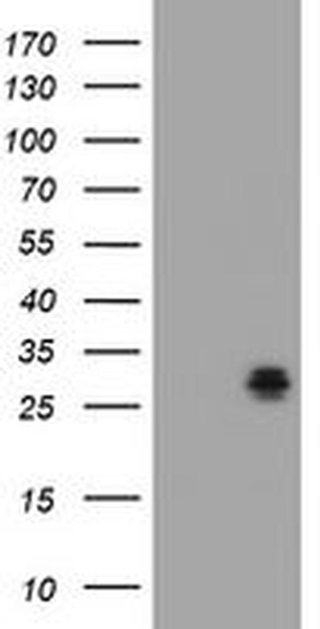 BCL10 Antibody in Western Blot (WB)