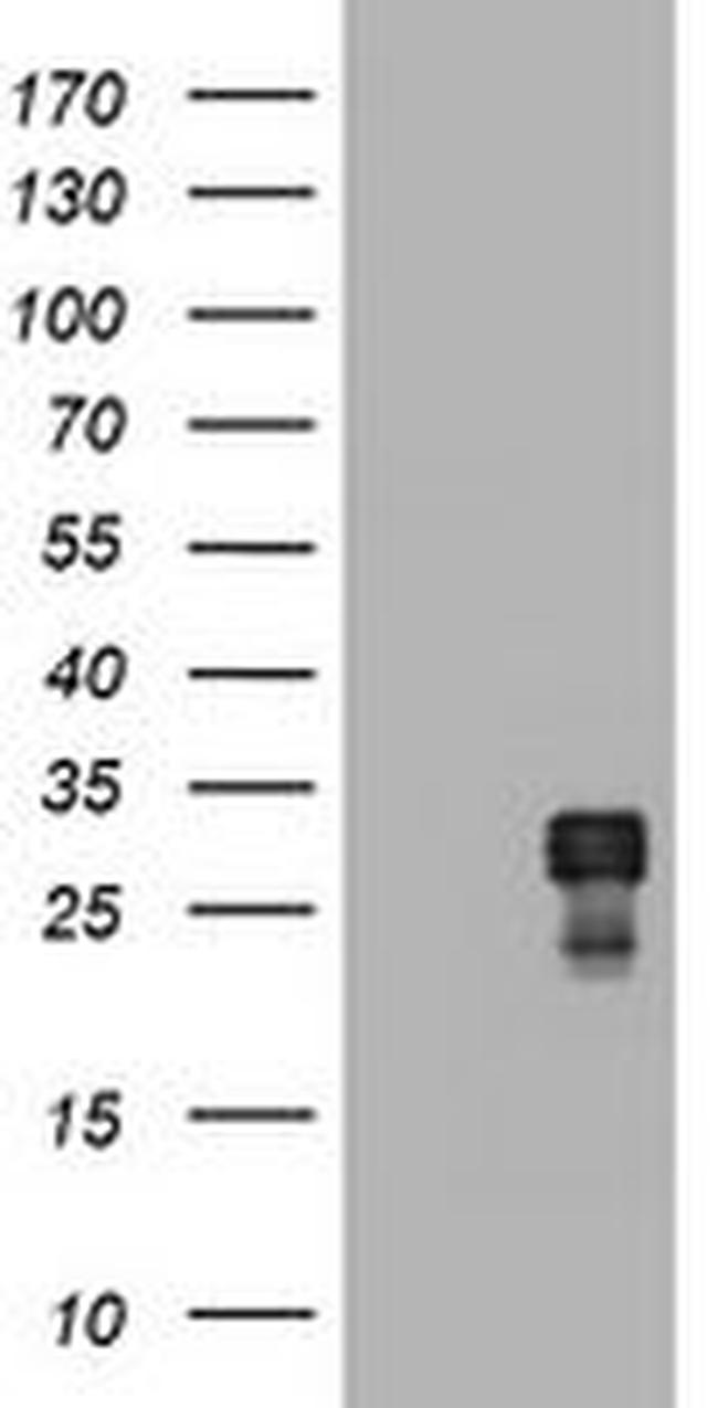 BCL10 Antibody in Western Blot (WB)