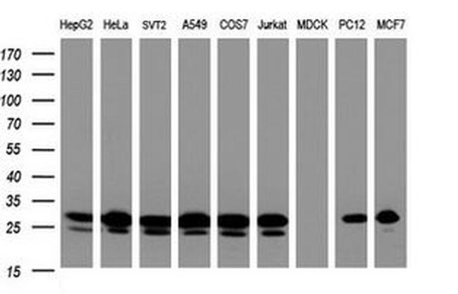 BCL10 Antibody in Western Blot (WB)