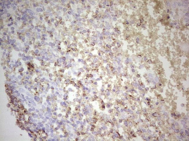 BCL2 Antibody in Immunohistochemistry (Paraffin) (IHC (P))