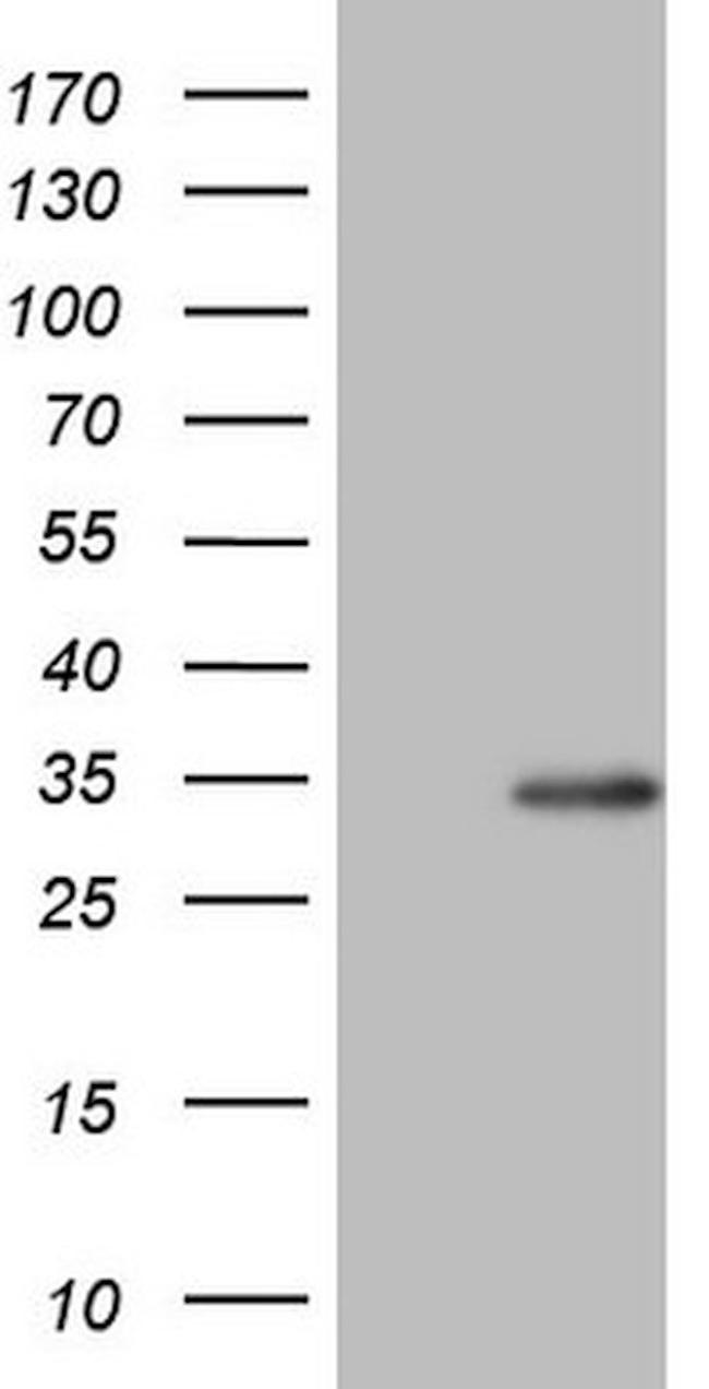 BCL2 Antibody in Western Blot (WB)