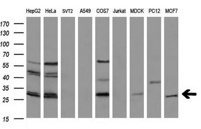 BCL2 Antibody in Western Blot (WB)