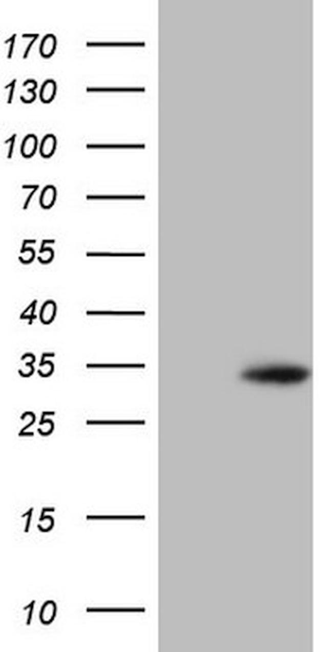 BCL2 Antibody in Western Blot (WB)