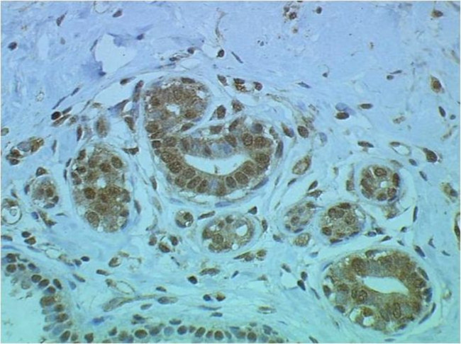 Bcl-3 Antibody in Immunohistochemistry (Paraffin) (IHC (P))