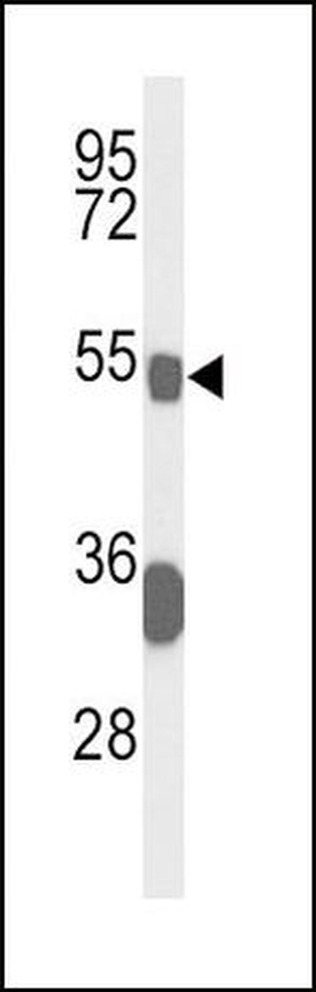 Bcl-3 Antibody in Western Blot (WB)