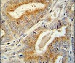 BCORL1 Antibody in Immunohistochemistry (IHC)