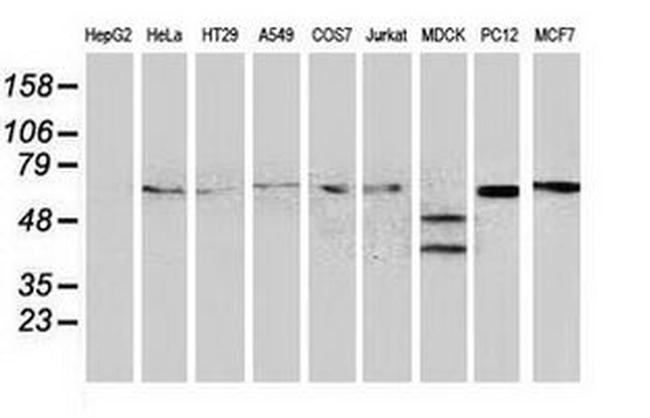 BECN1 Antibody in Western Blot (WB)