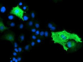 BEST3 Antibody in Immunocytochemistry (ICC/IF)