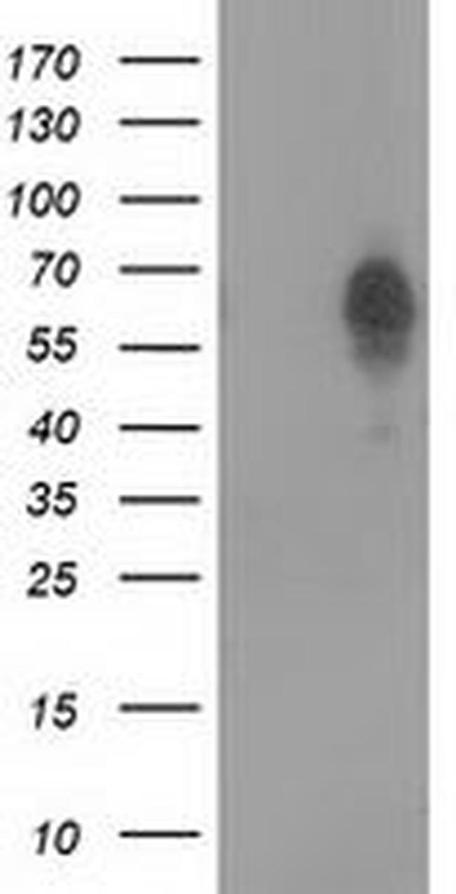 BEST3 Antibody in Western Blot (WB)