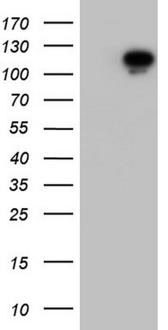 BFSP1 Antibody in Western Blot (WB)